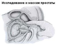prostata_massage.jpg