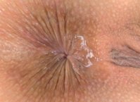 Girl Anus Picture