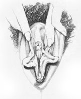 vulva1.jpg
