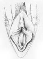 vulva4.jpg