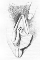 vulva5.jpg