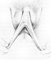 vulva6.jpg
