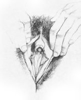 vulva11.jpg